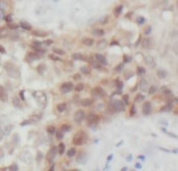 FOXO3 Rabbit Polyclonal Antibody