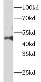 FOXO4 Rabbit Polyclonal Antibody