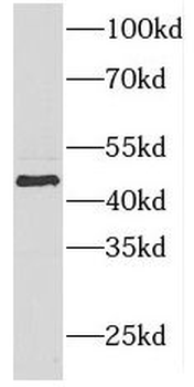 FOXO4 Rabbit Polyclonal Antibody