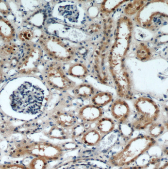 FOXO4 Rabbit Polyclonal Antibody