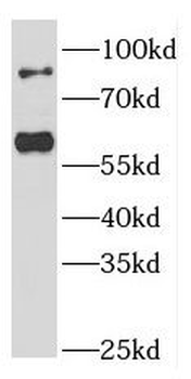 FOXP1 Rabbit Polyclonal Antibody