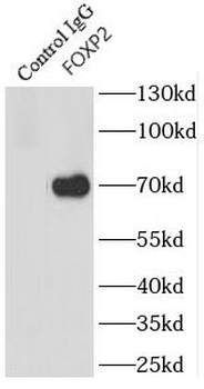FOXP2 Rabbit Polyclonal Antibody