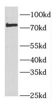 FOXP2 Rabbit Polyclonal Antibody
