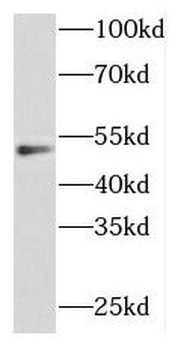 FOXP3 Rabbit Polyclonal Antibody
