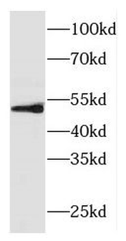FOXRED1 Antibody