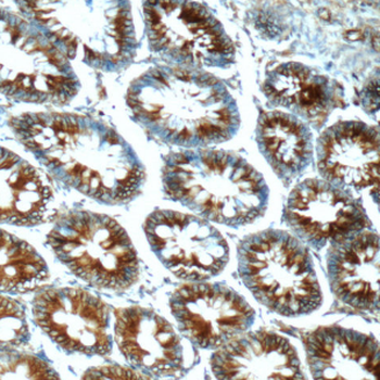 FPGT Antibody