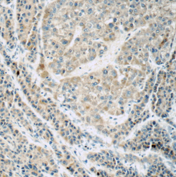 FREM1 Antibody