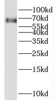 FZD7 Antibody