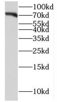 FZD8 Antibody