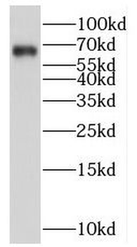 FZD9 Antibody