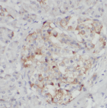 FRZB Antibody