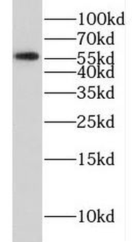 FSCN3 Antibody