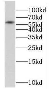 FSD1L Antibody