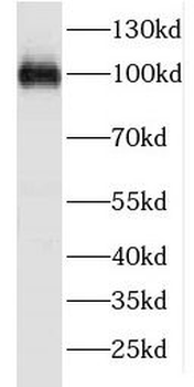 FSD2 Antibody