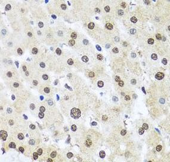 FUBP1 Antibody