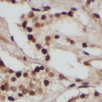 FUBP3 Antibody