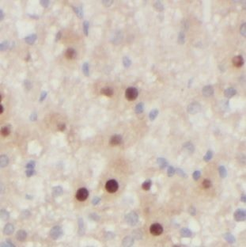 FUCA1 Rabbit Polyclonal Antibody