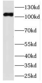 FCSK Antibody