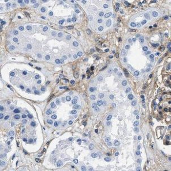 FCSK Antibody