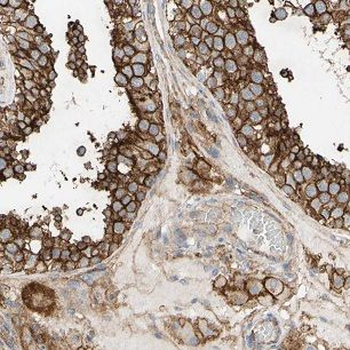 FUT10 Antibody