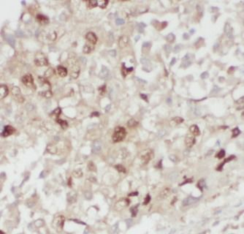 FUT4 Antibody