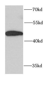 FUT6 Rabbit Polyclonal Antibody