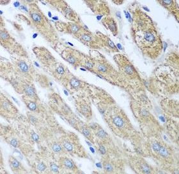 FUT6 Rabbit Polyclonal Antibody