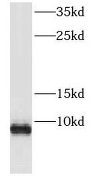 FXYD3 Rabbit Polyclonal Antibody