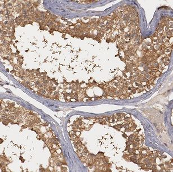 G3BP1 Antibody