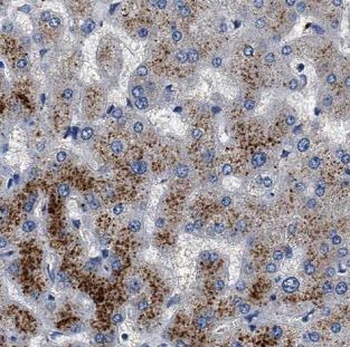 G6PC3 Antibody