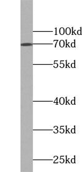 GAA Antibody