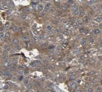 GAA Antibody