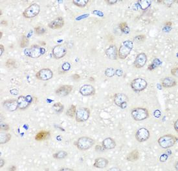 GABARAPL2 Antibody
