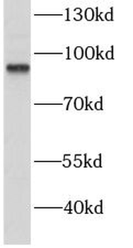 GABBR1 Antibody