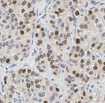 GABPA Antibody