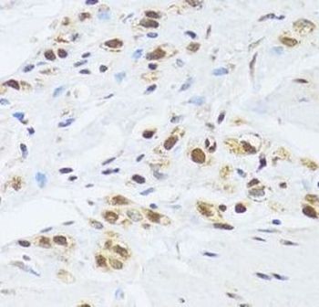 GABPB1 Antibody