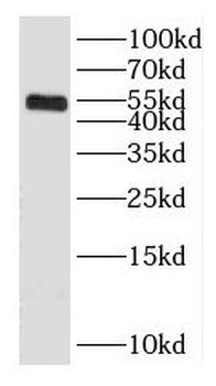 GABRA3 Rabbit Polyclonal Antibody