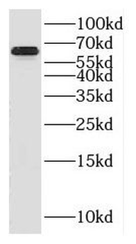 GABRA4 Rabbit Polyclonal Antibody