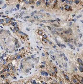 GABRG1 Antibody