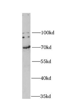 GAD2 Antibody