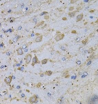 GAD2 Antibody