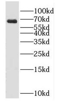 GAD2 Antibody