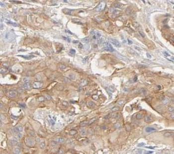 PPP1R15A Antibody