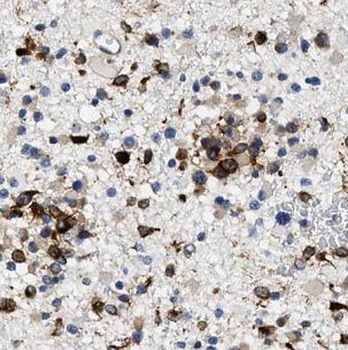 GAGE7 Antibody