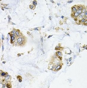 GALC Antibody
