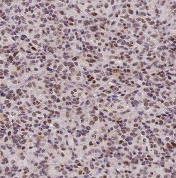 GALE Antibody