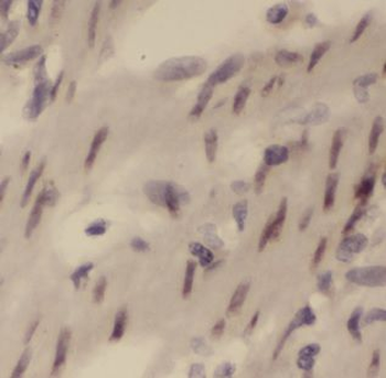 LGALS2 Rabbit Polyclonal Antibody