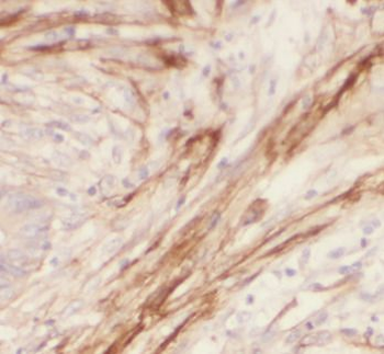 LGALS1 Antibody