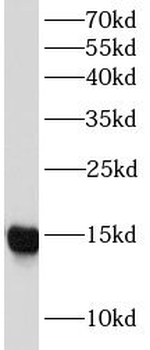 LGALS1 Mouse Monoclonal Antibody