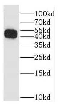 GALK1 Antibody